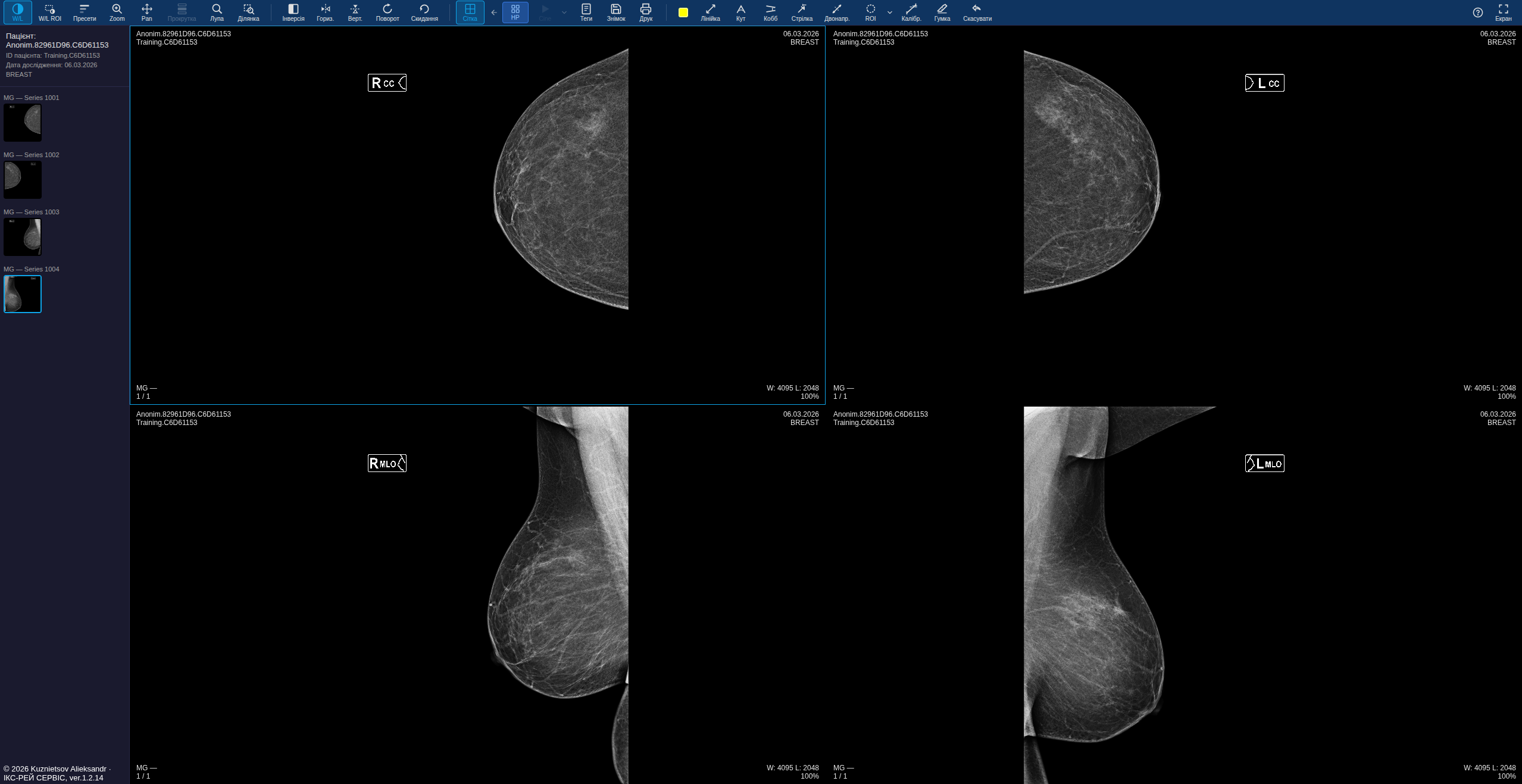 Интерфейс XrayWebViewer со стандартным набором инструментов просмотра